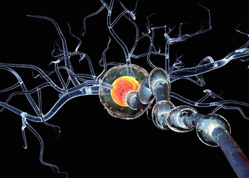 A Mottola “SCLEROSI MULTIPLA: terapie e aspetti psicologici”